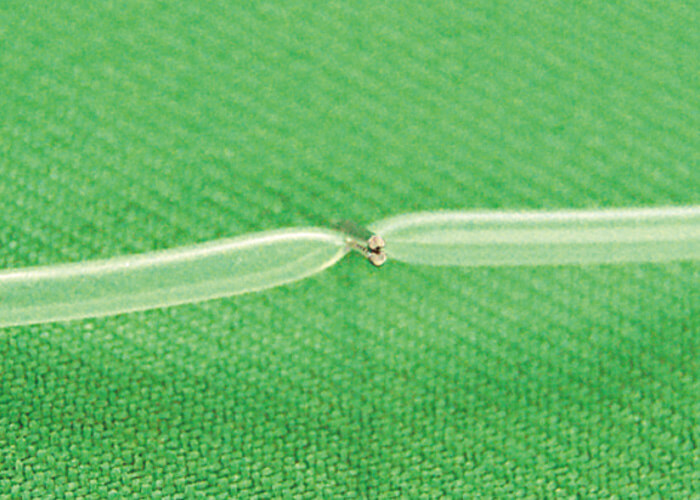 結紮アクションの特徴