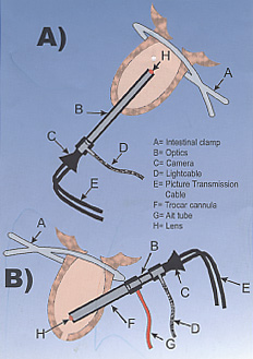 乳管構造図A・B