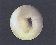 正常な乳管付近の状態