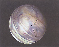 正常な乳頭内の状態