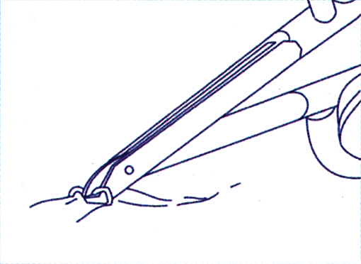 抜ピンステップ2