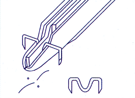 抜ピンステップ3